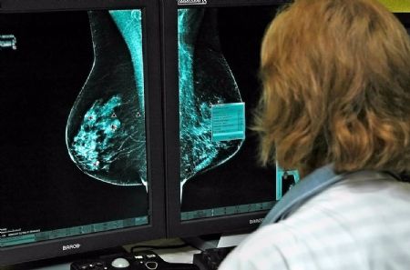 Onclogos estudian nuevos medicamentos contra el cncer de mama